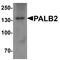Partner And Localizer Of BRCA2 antibody, NBP1-76317, Novus Biologicals, Western Blot image 