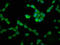 Protein Phosphatase 2 Regulatory Subunit Bbeta antibody, LS-C376380, Lifespan Biosciences, Immunofluorescence image 