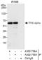 General Transcription Factor IIE Subunit 1 antibody, A302-754A, Bethyl Labs, Immunoprecipitation image 