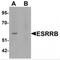 Estrogen Related Receptor Beta antibody, MBS150845, MyBioSource, Western Blot image 