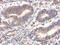 Fucose-1-Phosphate Guanylyltransferase antibody, PA5-31546, Invitrogen Antibodies, Immunohistochemistry paraffin image 