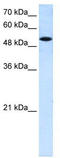 Solute Carrier Family 25 Member 25 antibody, TA334152, Origene, Western Blot image 