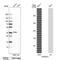 StAR Related Lipid Transfer Domain Containing 10 antibody, NBP1-84508, Novus Biologicals, Western Blot image 