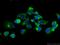 Capping Actin Protein Of Muscle Z-Line Subunit Beta antibody, 25043-1-AP, Proteintech Group, Immunofluorescence image 