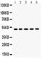 Aquaporin 2 antibody, PA5-78809, Invitrogen Antibodies, Western Blot image 