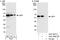 Latent membrane protein 1 antibody, A301-957A, Bethyl Labs, Western Blot image 