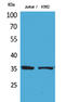APX antibody, STJ96686, St John