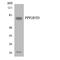 Protein Phosphatase 2 Regulatory Subunit B'Delta antibody, LS-C200519, Lifespan Biosciences, Western Blot image 