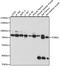V-type proton ATPase 116 kDa subunit a isoform 3 antibody, A15382, ABclonal Technology, Western Blot image 