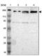 DNA polymerase alpha catalytic subunit antibody, PA5-51784, Invitrogen Antibodies, Western Blot image 