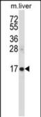 Zinc Ribbon Domain Containing 2 antibody, PA5-48613, Invitrogen Antibodies, Western Blot image 