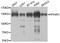 Protein Phosphatase 4 Regulatory Subunit 1 antibody, STJ110659, St John