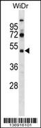 SPT7 Like, STAGA Complex Gamma Subunit antibody, 58-915, ProSci, Western Blot image 