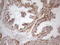 Napsin A Aspartic Peptidase antibody, LS-C794492, Lifespan Biosciences, Immunohistochemistry paraffin image 