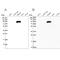 Insulin Like Growth Factor Binding Protein Acid Labile Subunit antibody, PA5-59252, Invitrogen Antibodies, Western Blot image 