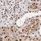 Glyoxylate Reductase 1 Homolog antibody, NBP2-38576, Novus Biologicals, Immunohistochemistry paraffin image 