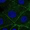 Actin Related Protein 2/3 Complex Subunit 1A antibody, NBP1-88851, Novus Biologicals, Immunofluorescence image 