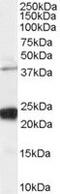 GIPC PDZ Domain Containing Family Member 1 antibody, MBS421016, MyBioSource, Western Blot image 