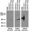 ARF GTPase-activating protein GIT2 antibody, 73-126, Antibodies Incorporated, Western Blot image 