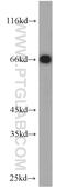 Lipopolysaccharide Binding Protein antibody, 11836-1-AP, Proteintech Group, Western Blot image 