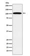 ATPase Na+/K+ Transporting Subunit Alpha 2 antibody, M02064, Boster Biological Technology, Western Blot image 