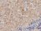 Peroxisomal Trans-2-Enoyl-CoA Reductase antibody, LS-C115675, Lifespan Biosciences, Immunohistochemistry frozen image 