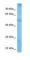 RAN Binding Protein 9 antibody, orb325878, Biorbyt, Western Blot image 