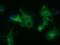 Histone Deacetylase 6 antibody, GTX84377, GeneTex, Immunofluorescence image 