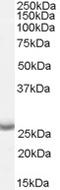 Aph-1 Homolog A, Gamma-Secretase Subunit antibody, TA303251, Origene, Western Blot image 