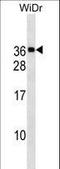 Mediator Complex Subunit 30 antibody, LS-C158125, Lifespan Biosciences, Western Blot image 