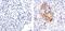 Interleukin 1 Receptor Associated Kinase 1 antibody, 700025, Invitrogen Antibodies, Immunohistochemistry paraffin image 