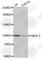 Phosphatidylinositol 3-Kinase Catalytic Subunit Type 3 antibody, A0952, ABclonal Technology, Western Blot image 