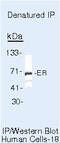 Estrogen Receptor 1 antibody, MA5-13062, Invitrogen Antibodies, Immunoprecipitation image 