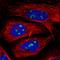 Zinc Finger Protein 142 antibody, HPA049594, Atlas Antibodies, Immunofluorescence image 