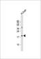 Interferon Beta 1 antibody, GTX81187, GeneTex, Western Blot image 