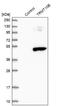TRNA Methyltransferase 10B antibody, NBP1-88770, Novus Biologicals, Western Blot image 