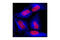 Tubulin antibody, 3624S, Cell Signaling Technology, Immunofluorescence image 