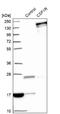 Colony Stimulating Factor 1 Receptor antibody, NBP1-84532, Novus Biologicals, Western Blot image 