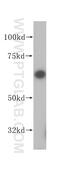 Asparagine Synthetase (Glutamine-Hydrolyzing) antibody, 14681-1-AP, Proteintech Group, Western Blot image 