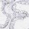 Transmembrane And Coiled-Coil Domains 6 antibody, NBP1-83464, Novus Biologicals, Immunohistochemistry frozen image 