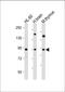 Endo-Beta-N-Acetylglucosaminidase antibody, A08768, Boster Biological Technology, Western Blot image 