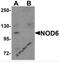 NLR Family Pyrin Domain Containing 9 antibody, 5955, ProSci, Western Blot image 