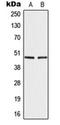 Interferon Regulatory Factor 4 antibody, orb216135, Biorbyt, Western Blot image 