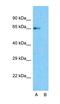 G Protein-Coupled Receptor 160 antibody, orb183879, Biorbyt, Western Blot image 