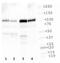 Transient Receptor Potential Cation Channel Subfamily V Member 1 antibody, NBP1-97417, Novus Biologicals, Western Blot image 