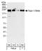 DNA Topoisomerase II Beta antibody, A300-950A, Bethyl Labs, Western Blot image 