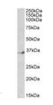 Neuronal Differentiation 4 antibody, orb18432, Biorbyt, Western Blot image 