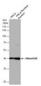 Ribonuclease H2 Subunit B antibody, GTX632104, GeneTex, Western Blot image 