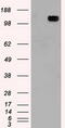 Transient Receptor Potential Cation Channel Subfamily M Member 4 antibody, CF500370, Origene, Western Blot image 