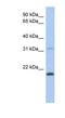 C-Type Lectin Like 1 antibody, NBP1-54397, Novus Biologicals, Western Blot image 